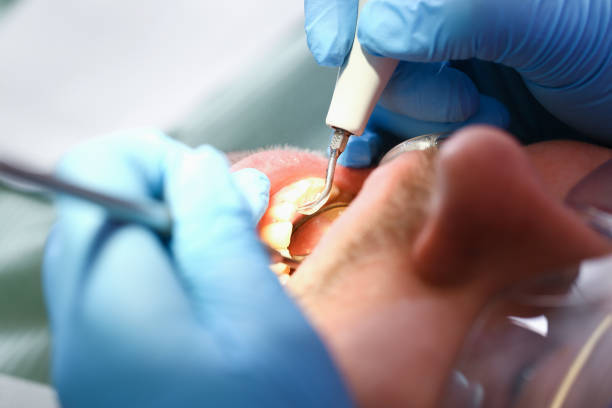Best Cracked Tooth Emergency Dentist  in Troy, PA
